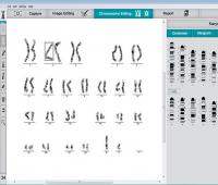 Karyotype System