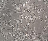 Human Skin Fibroblasts