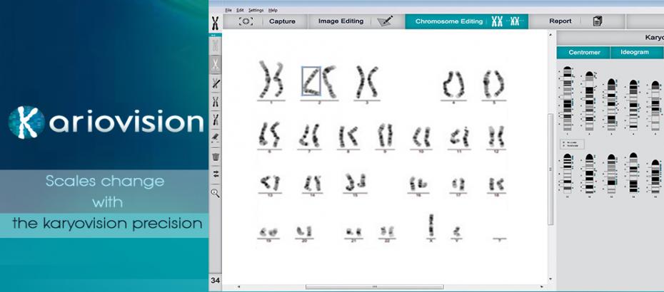 KaryoVision®